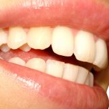 Devet prirodnih načina za izbeljivanje zuba 14