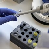 Direktor IZJZ: Institut nikada nije prestajao sa testiranjem, do sada urađeno 3.000 PCR analiza 5