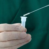 Australijski doktori: „Dugi kovid“ ne postoji, simptomi korona virusa ništa drugačiji od gripa 5
