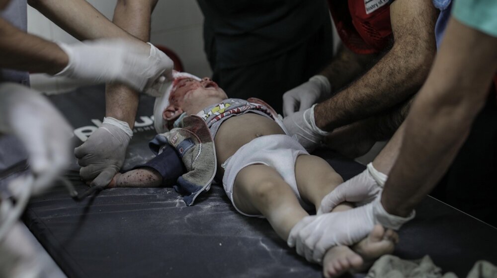 palestinsko dete povređeno u izraelskom bombardovanju u pojasu gaze