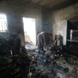 Ranjen dopisnik Al Džazire u pojasu Gaze 6