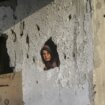 Kožne bolesti se šire u ratom razorenoj Gazi: Više od 160.000 slučajeva šuge, vaški i osipa 10