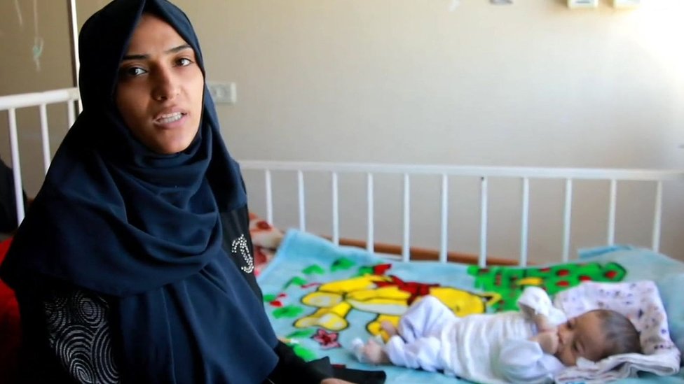 Petomesečni Abdulaziz leži u krevetu u bolnici Al-Ahli u severnoj Gazi, u pratnji majke koja je obučena u crnu abaju