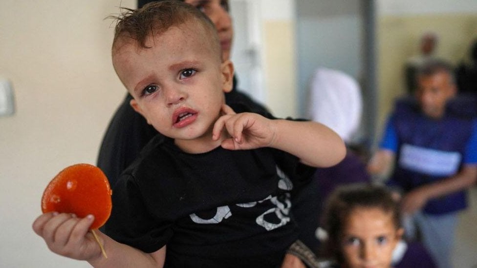 Dečak u naručju odrasle osobe u bolnici Naser u Gazi 24. juna 2024.