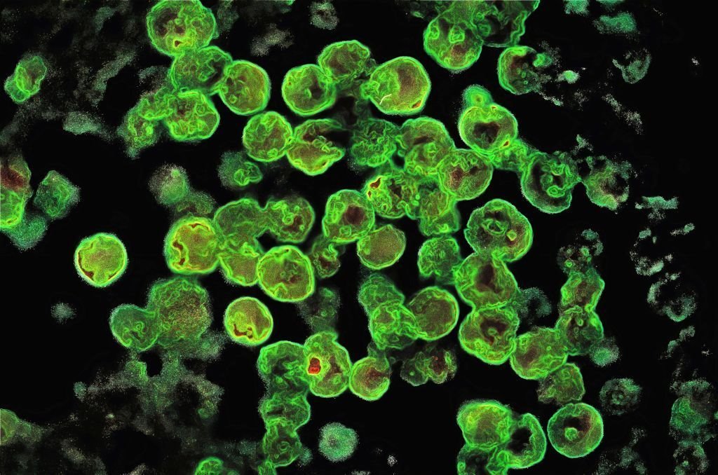 ameba naegleria fowleri ulazi u ljudsko telo preko nosa