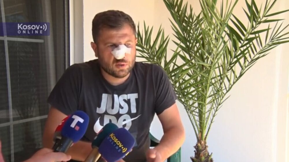 Srbinu polomljen nos, kaže da je sa komšijom Albancem imao problem oko povrća 1