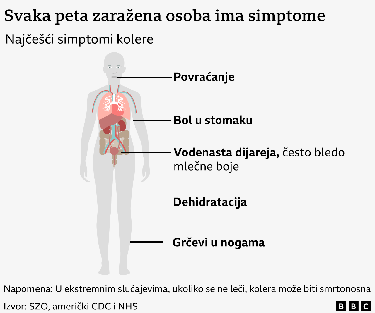 Kolera